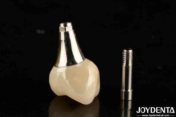 Buy cheap Biocompatible Dental Implant Crown And Bridge Aesthetically Pleasing For Safe Oral from wholesalers