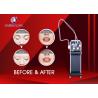 Buy cheap Medical Picosecond ND YAG Laser Machine Portable Tattoo Removal Machine from wholesalers