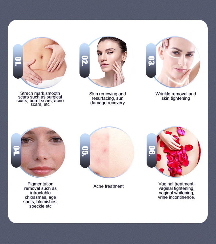 Glass Tube Co2 Fractional Laser Machine 635nm For Skin Birthmark Acne Removal