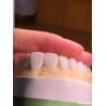 Buy cheap Customized Digital Diagnostic Wax Ups for Natural Tooth Anatomy Replication from wholesalers