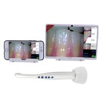 Buy cheap 8 Mega Dental Equipment Dental Mouth Mirror 3d Intra Oral Camera Scanner With product