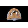 Buy cheap CorCr Metal Partial Denture High Light Beryllium Free Ivoclar Scheftner Comfortable Metal Framewrok from wholesalers