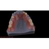 Buy cheap 3D Print Model High Esthetics Dental TCS Valplast Flexible Partial Dentures Dental Lab from wholesalers