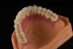 Roughened Surface Titanium Dental Implants Surgery For Front Tooth Replacement