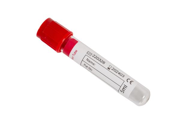 Buy cheap Pain Red Top Blood Tube No Additive Blood Collection Tubes Bd No Additive Tube from wholesalers