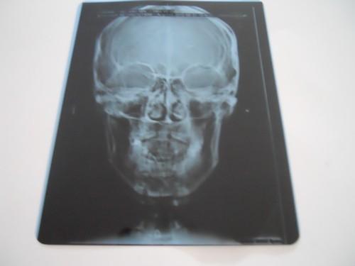 Buy cheap Professional Dry Imaging Film With Image Layer 14x17inch from wholesalers