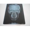 Buy cheap Professional Dry Imaging Film With Image Layer 14x17inch from wholesalers