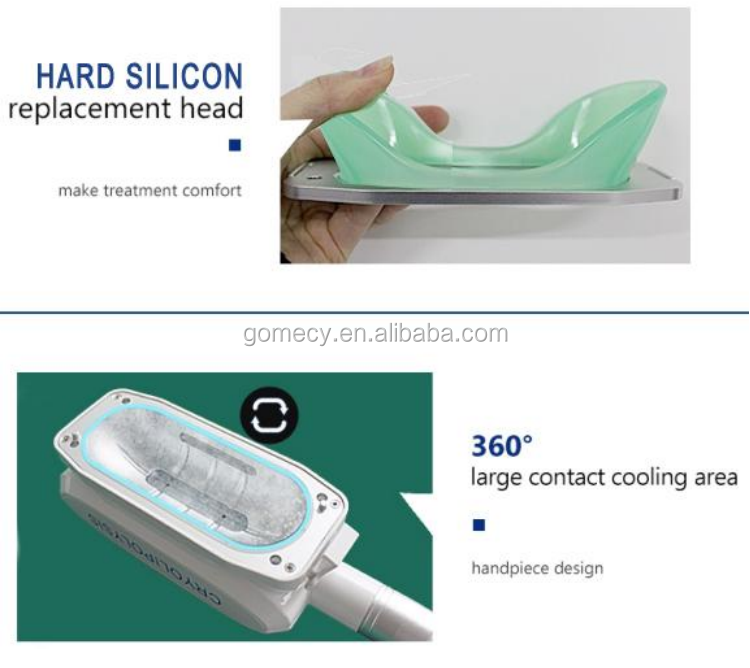 body slimming cryolipolysis.png