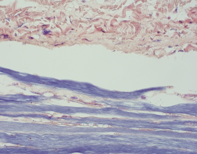 Clear Colourful Phosphotungstic Acid Hematoxylin Stain For Hospital Clinic