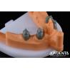 Buy cheap Precision Removable Prosthesis Dental Implant Attachments Easy Clean Comfortable Fit from wholesalers