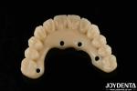 Dental Solution Ti-Base Zirconia Hybrid Bridge High Biocompatibility Natural