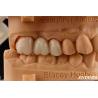 Buy cheap High Flexural Strength Full Contour Zirconia For Crowns Bridges Dental Restoration from wholesalers