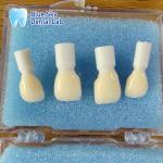 Natural Looking Layered Zirconia High Strength Zircon Multilayer Rectangular