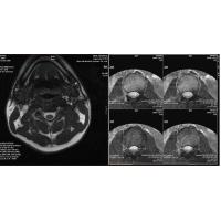 Buy cheap Dry Laser X Ray Medical Imaging For AGFA 5300 / 5302 / 5500 , 35cm x 43cm product