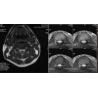 Buy cheap Eco-Friendly Medical Dry Film Agfa 2B X Ray With CT Machine from wholesalers