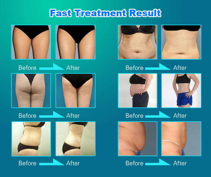 Commercial Cavitation RF Vacuum Slimming Machine 7 in 1 For Beauty Center