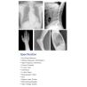 Buy cheap 20KW 50KW Medical X Ray Radiological Equipment Lightweight from wholesalers