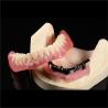 Buy cheap CAM Milled Titanium Bar Dental Implant Hybrid Prosthesis Dentures from wholesalers