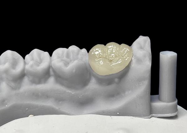Buy cheap Accurate Fit Dental Ceramic Inlays Onlays , Porcelain Inlays And Onlays FDA Approved from wholesalers