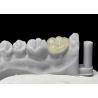Buy cheap Accurate Fit Dental Ceramic Inlays Onlays , Porcelain Inlays And Onlays FDA Approved from wholesalers