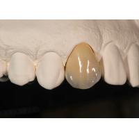 Buy cheap Staining Resistance Solid Zirconia Crown for front teeth posterior teeth product