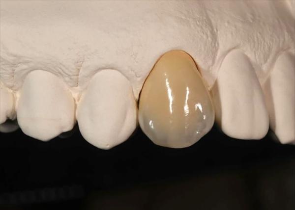 Buy cheap Staining Resistance Solid Zirconia Crown for front teeth posterior teeth from wholesalers