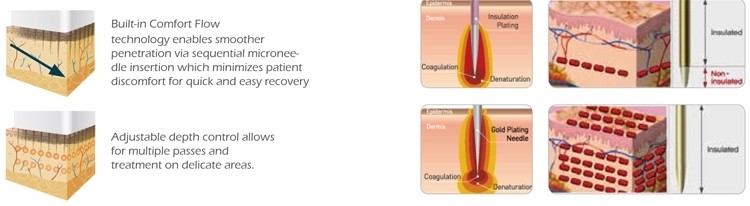 Nubway New Arrival!!! Fractional rf microneedle skin rejuvenation ce approved rf fractional micro needle machine