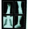 Buy cheap Silk Screen Medical Inkjet Film Glossy Surface Waterproof from wholesalers