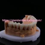 FDA High Esthetics Dental Zirconia Bridge With Layered Porcelain zirconia dental