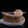 Buy cheap FDA High Esthetics Dental Zirconia Bridge With Layered Porcelain zirconia dental crown China Dental Lab from wholesalers