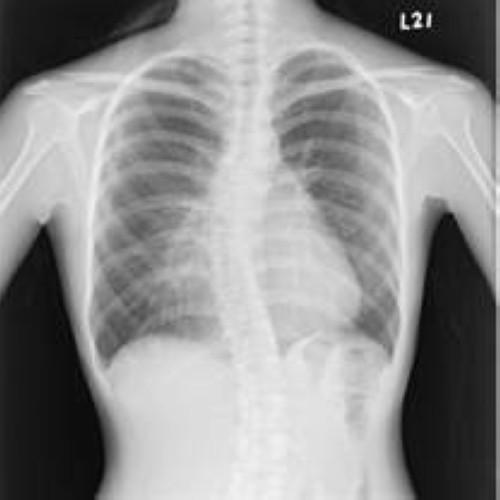 Buy cheap KND-A / F Medical X Ray Films from wholesalers