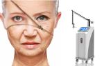 Professional scar and acne removal Fractional Laser Co2/ Vigenal tightening