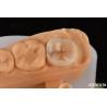 Buy cheap 0.5mm-2mm Precise Fit Emax Dental Inlay Onlay For Reliable Tooth Restoration from wholesalers