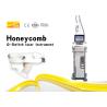Buy cheap Q Switched Professional Tattoo Removal Machine Stationary Style In White Color from wholesalers
