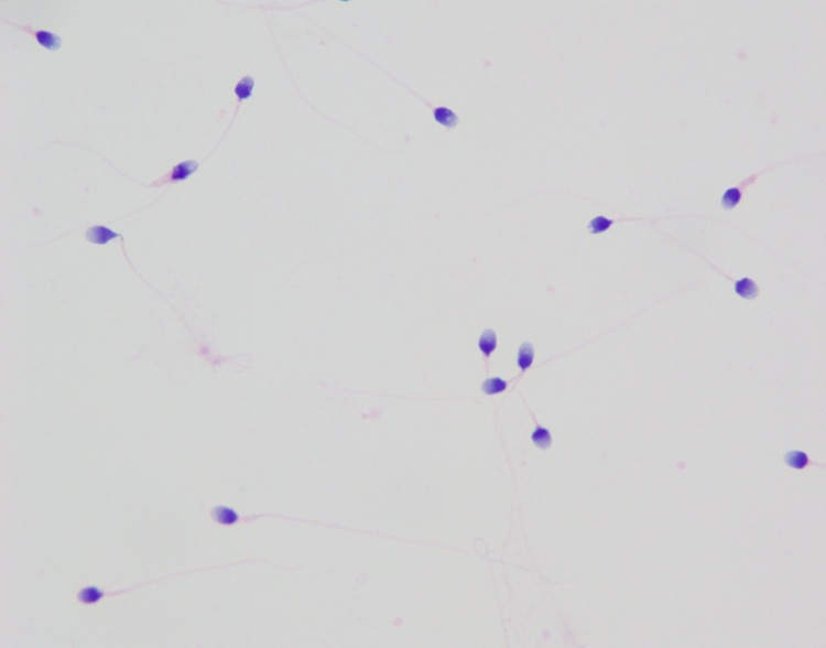 Faster Staining Modified Sperm Pap Stain Papanicolaou Stain For Automatic Stainer