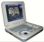 Diagnostic Laptop Ultrasound Machine Digital Ultrasound Scanner Durable