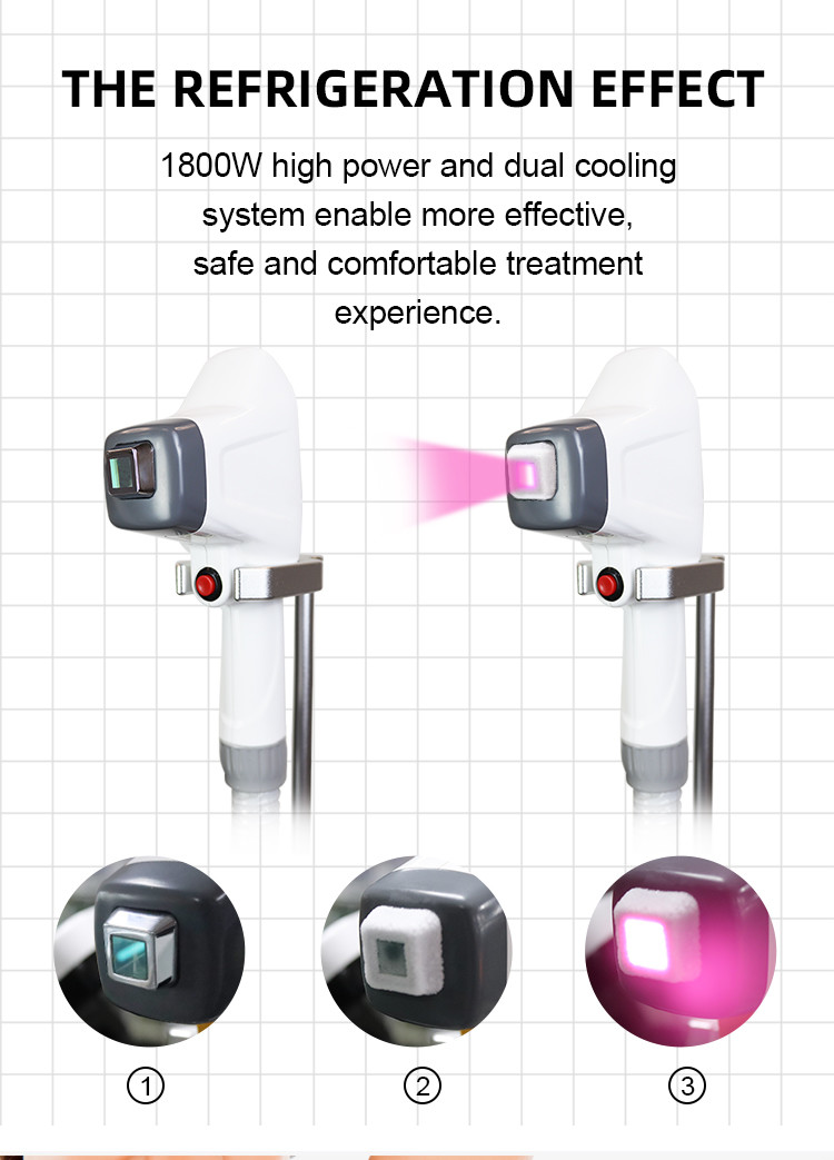 New Permanent Hair Removal 1800W Fiber Coupled Laser Hair Removal Machine For Bikini Area