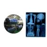 Buy cheap Medical Film Blue Thermal Film 210micron CT DR Film 8x10 10x12 11x14 14x17 Sheet For Medical Printing Media from wholesalers