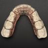 Buy cheap Comfortable Stainless Steel Acrylic Hawley Retainer Effective Orthodontic Solution from wholesalers