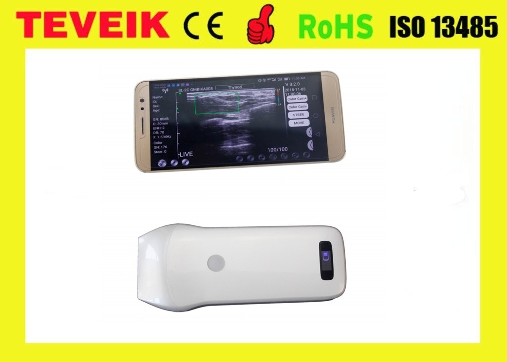 Factory Price Medical Digital 7.5MHz High Frequency Doppler Linear Ultrasound Scanner Probe
