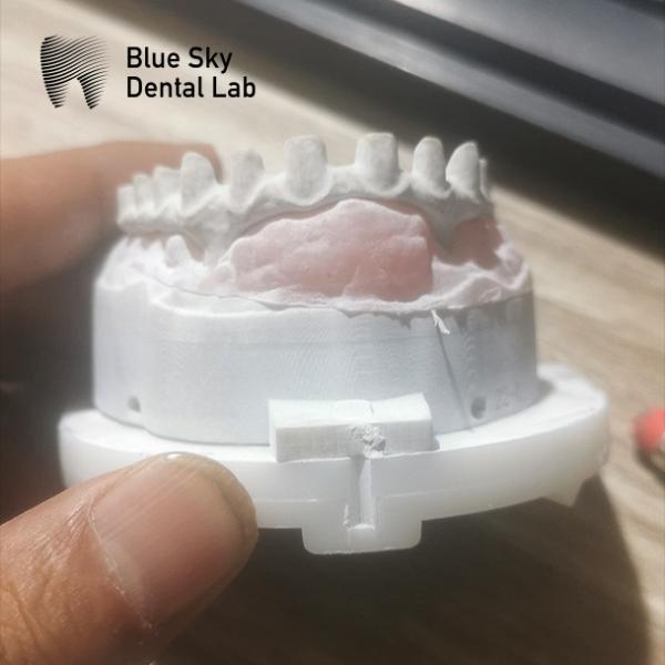 Buy cheap Customizable Industrial Malo Bridge In Silver And Gold Malo Implant Bridge from wholesalers