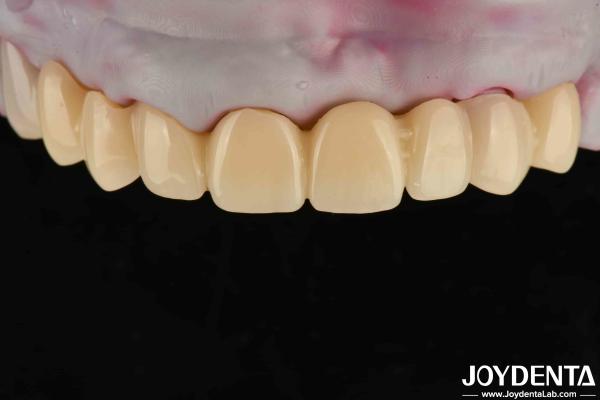 Buy cheap High Transparency PMMA Dental Material Natural Color Lifelike Aesthetics from wholesalers
