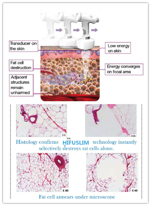 30 degree screen rotation ODM & OEM available hifuslim Beauty machine