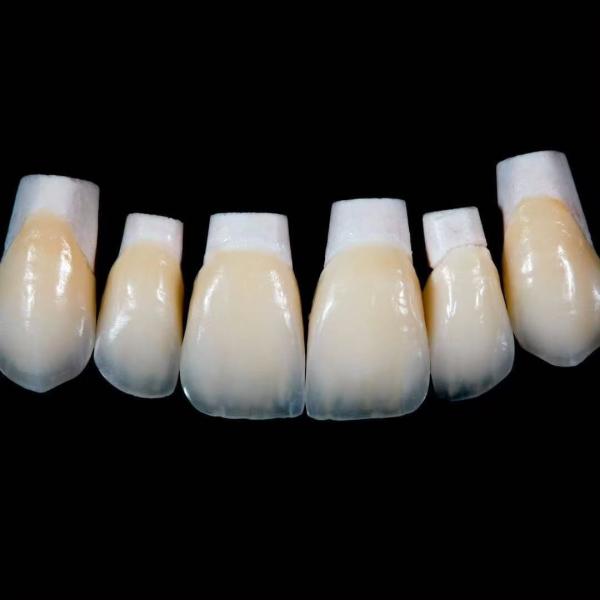 Buy cheap High Translucency Emax Porcelain Veneers Crown with Better Materials by Ivoclar Vivadent from wholesalers