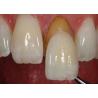 Buy cheap Precision 0.2-0.5mm EMAX Cosmetic Teeth Veneers Natural Looking Chemical Bonding from wholesalers