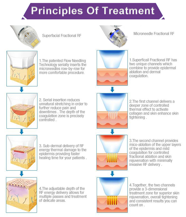 Portable Gold Micro Needle Equipment Radio Frequency Fractional RF Microneedle Machine For Ance Treatment