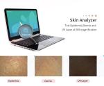 Face Skin Analyzer Machine Camera Portable Resolution 1600*1200 USB 5V ABS