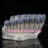 Buy cheap SDL Dental Lab Digital Diagnostic Wax Ups Crown Bridge from wholesalers