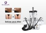 Ultrasound Weight Loss Vacuum Slimming Machine 50mm Cavitation Head Diameter