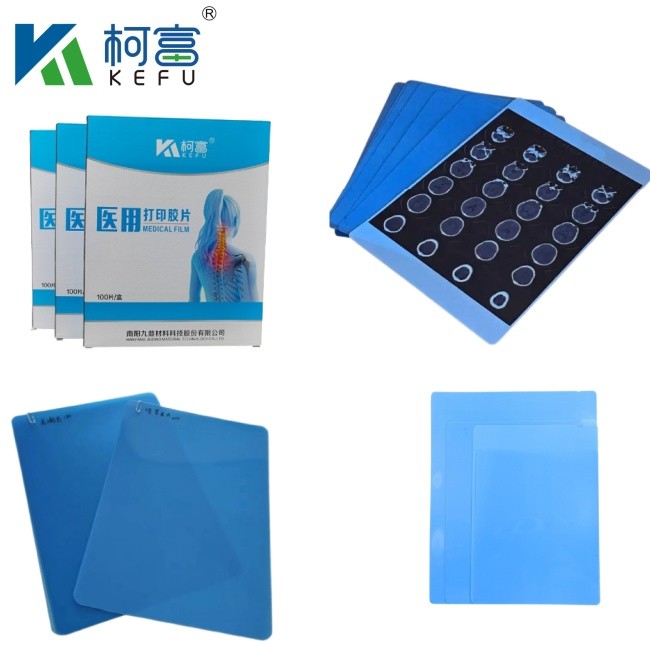 Professional Production Medical Blue X Ray Film Inkjet Film Laser Printing Medical X Ray Film Customized Size